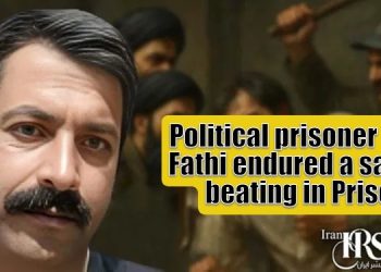 Omid Fathi suffered brutal beating by Vakilabad Prison guards on Oct 17, 2025. Eye damage, bruises worsen; family denied info.